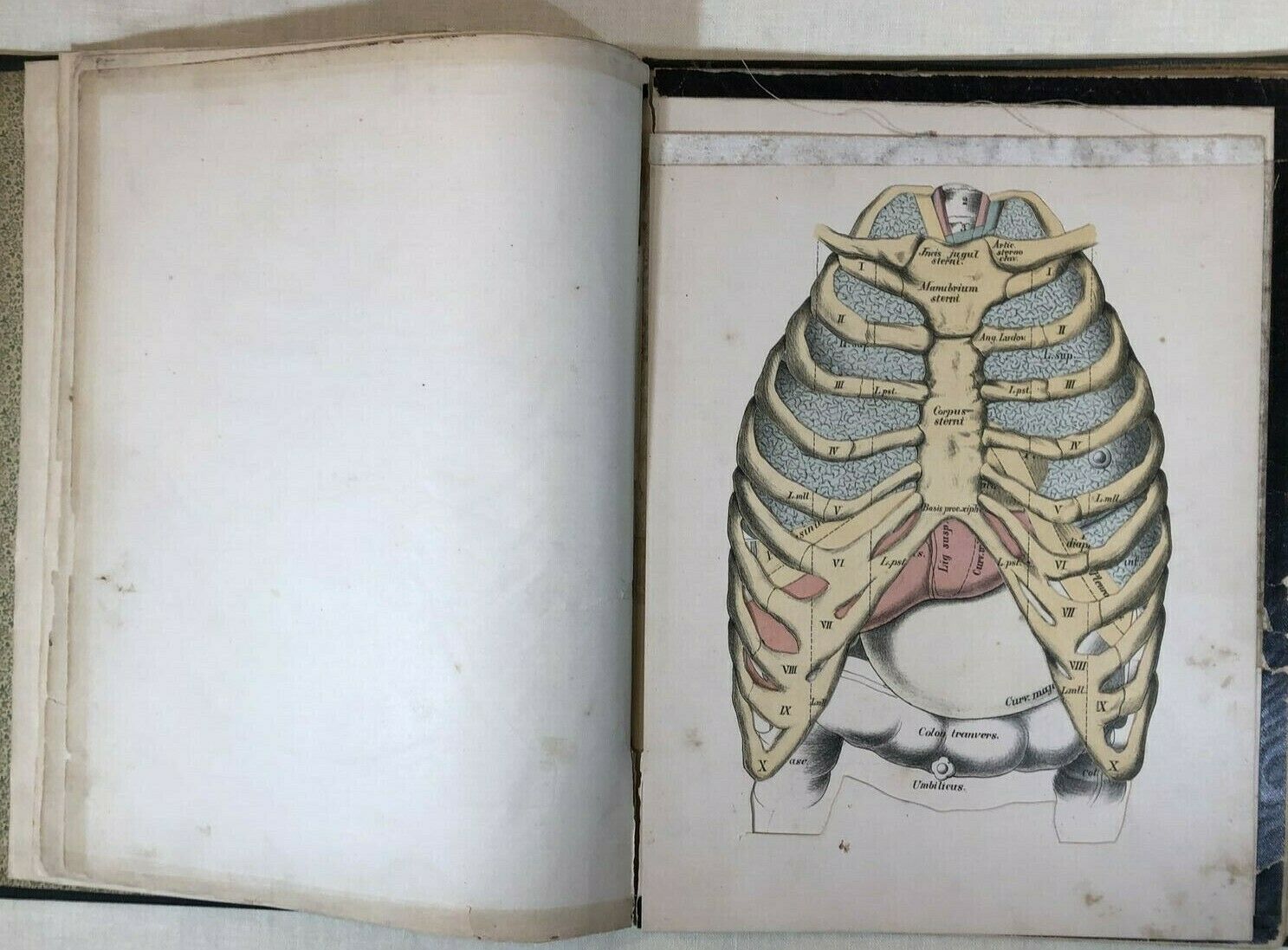 Rare 19th C 1878 Book A Manual Physical Diagnosis Delafield Anatomy Color Litho